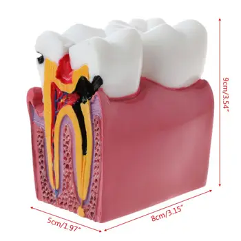 Dropship 6 zubný Kaz Comparation Anatómia Zubov Model pre Zubné Laboratória Anatómie Čaj